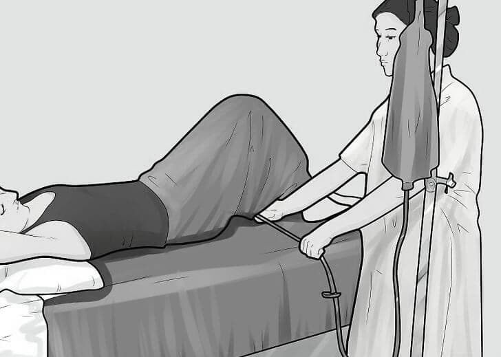 Enemas y purgas