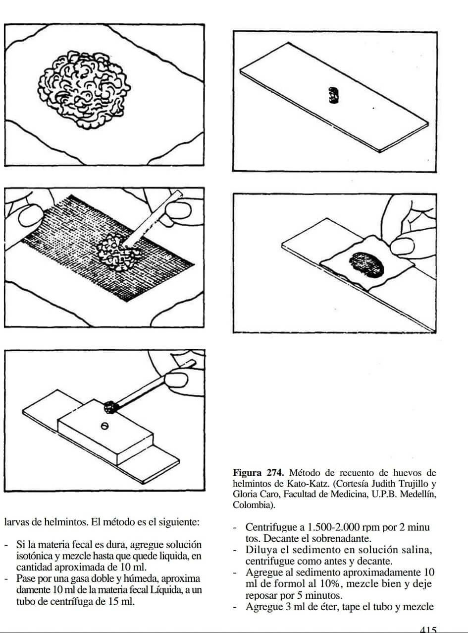 Extracto del Parasitosis Humanas de Botero