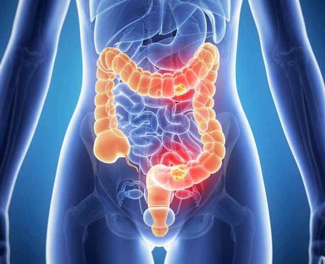 Intestinos