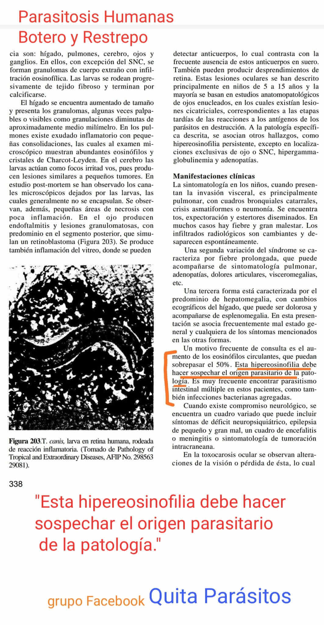 DocEosinofilia