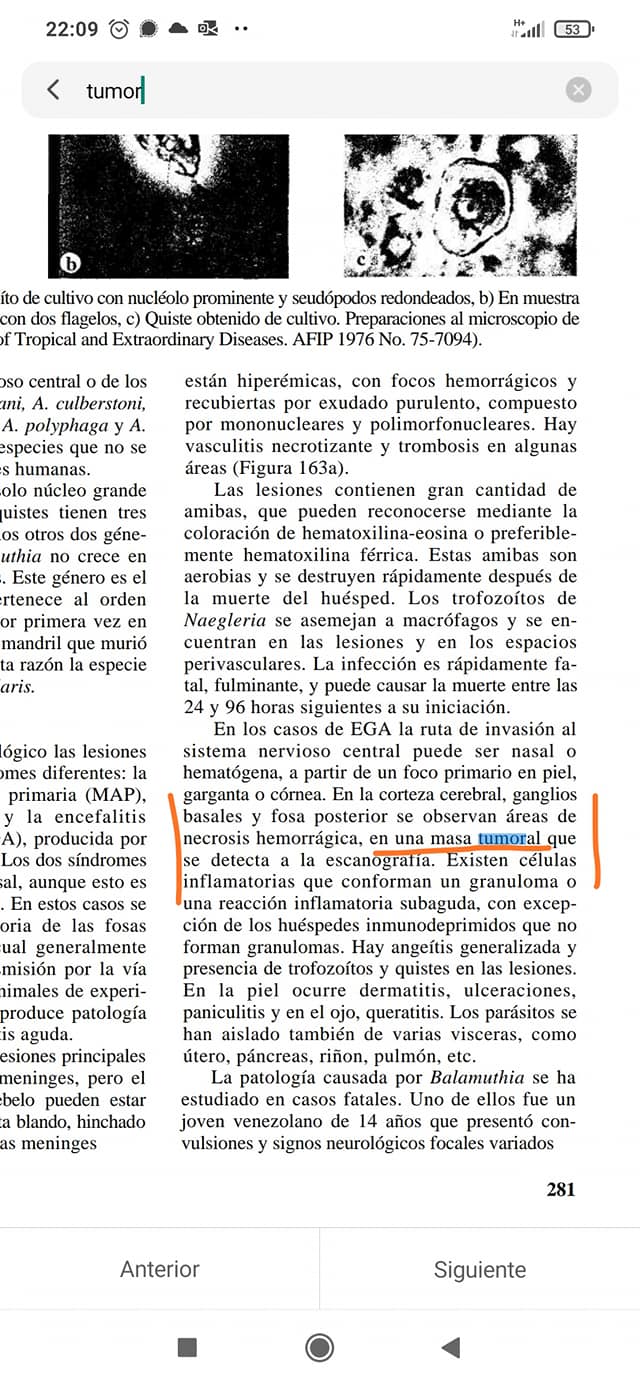 Cáncer