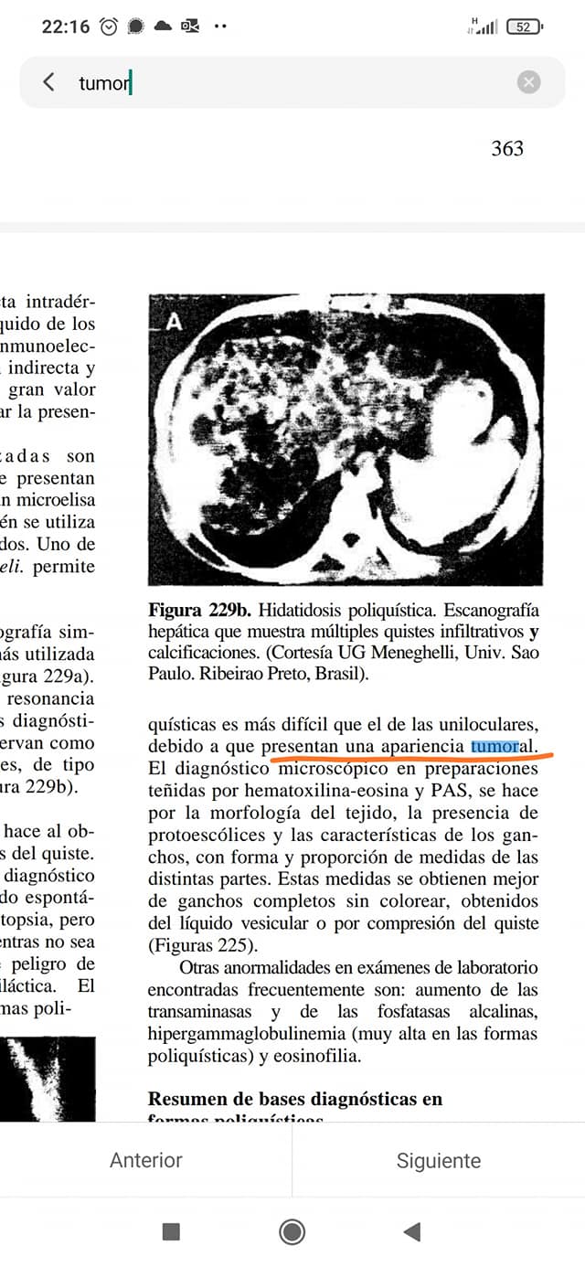 Cáncer